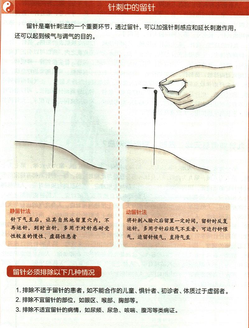 針刺穴位時有哪些需要注意的？